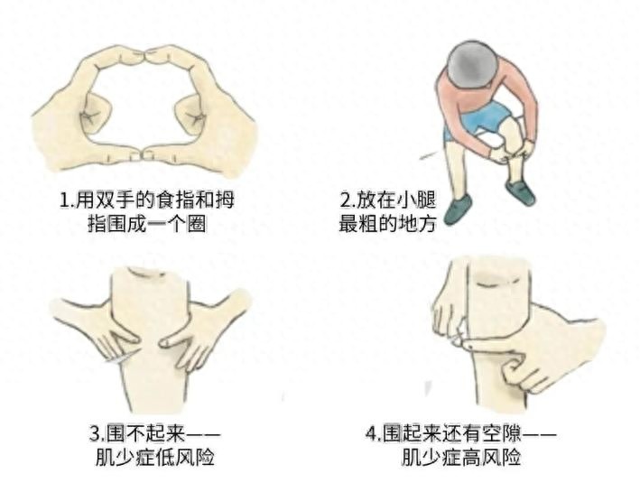 肌肉流失风险_体育运动中预防运动损伤意义_抗衰肌肉重要性