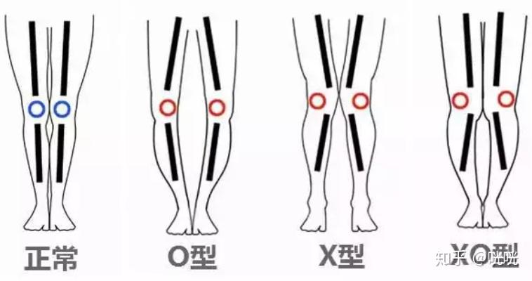 瘦腿操练视频_脂肪腿改善法_瘦腿训练方法
