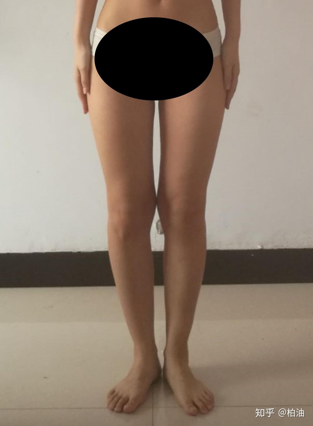 腿型分析_腿向后踢屁股有什坏处_X型腿O型腿区别